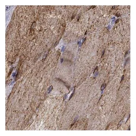 Immunohistochemistry (Formalin/PFA-fixed paraffin-embedded sections) - Anti-MAP4 antibody (AB224543)