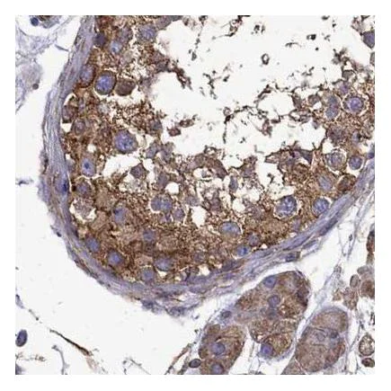 Immunohistochemistry (Formalin/PFA-fixed paraffin-embedded sections) - Anti-MAP4 antibody (AB224543)