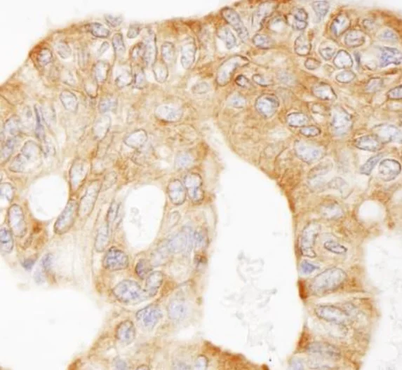 Immunohistochemistry (Formalin/PFA-fixed paraffin-embedded sections) - Anti-MAP4 antibody (AB245578)