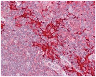 Immunohistochemistry (Formalin/PFA-fixed paraffin-embedded sections) - Anti-MAP4K1/HPK1 antibody (AB129319)