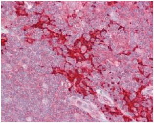 Immunohistochemistry (Formalin/PFA-fixed paraffin-embedded sections) - Anti-MAP4K1/HPK1 antibody (AB129319)