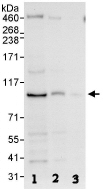 Western blot - Anti-MAP4K1/HPK1 antibody (AB86043)