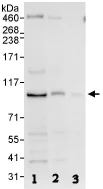 Western blot - Anti-MAP4K1/HPK1 antibody (AB86043)