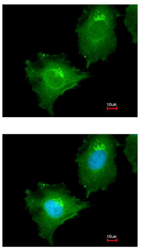 Immunocytochemistry/ Immunofluorescence - Anti-MAP4K4/NIK antibody (AB155583)