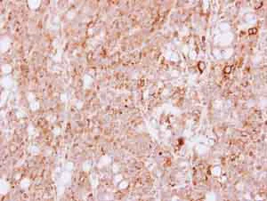 Immunohistochemistry (Formalin/PFA-fixed paraffin-embedded sections) - Anti-MAP4K4/NIK antibody (AB155583)