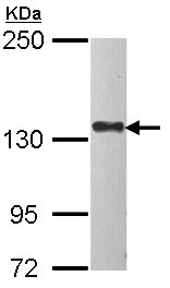 Western blot - Anti-MAP4K4/NIK antibody (AB155583)