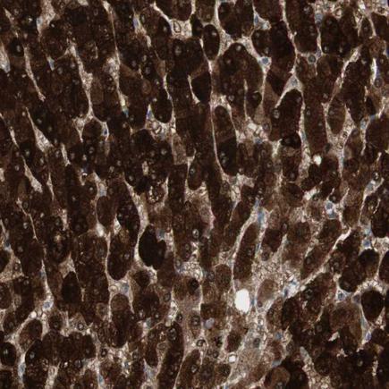 Immunohistochemistry (Formalin/PFA-fixed paraffin-embedded sections) - Anti-MAP4K4/NIK antibody (AB243321)