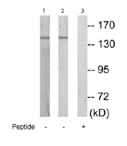 Western blot - Anti-MAP4K4/NIK antibody (AB69885)
