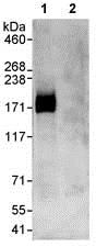 Immunoprecipitation - Anti-MAP4K4/NIK antibody (AB80418)