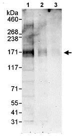 Western blot - Anti-MAP4K4/NIK antibody (AB80418)