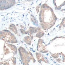 Immunohistochemistry (Formalin/PFA-fixed paraffin-embedded sections) - Anti-MAP4K4/NIK antibody [SP177] - BSA and Azide free (AB245752)