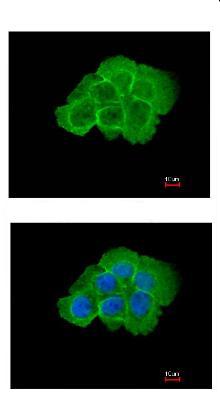 Immunocytochemistry/ Immunofluorescence - Anti-MAP4K5 antibody (AB96551), expandable thumbnail