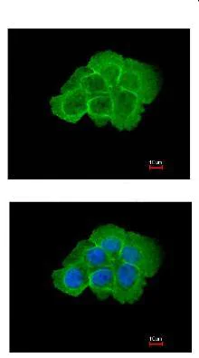 Immunocytochemistry/ Immunofluorescence - Anti-MAP4K5 antibody (AB96551)