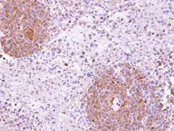 Immunohistochemistry (Formalin/PFA-fixed paraffin-embedded sections) - Anti-MAP4K5 antibody (AB96551)