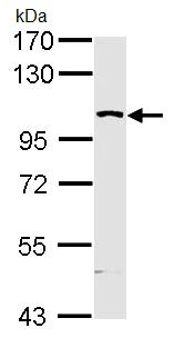Western blot - Anti-MAP4K5 antibody (AB96551)
