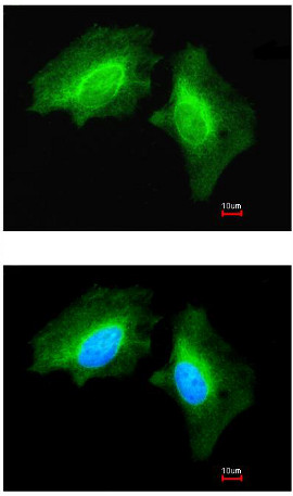 Immunocytochemistry/ Immunofluorescence - Anti-MAP4K6 antibody - C-terminal (AB154256)