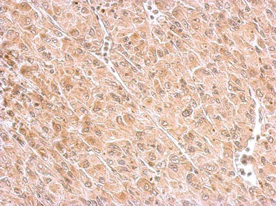 Immunohistochemistry (Formalin/PFA-fixed paraffin-embedded sections) - Anti-MAP4K6 antibody - C-terminal (AB154256)