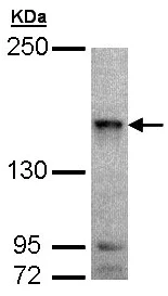 Western blot - Anti-MAP4K6 antibody - C-terminal (AB154256)