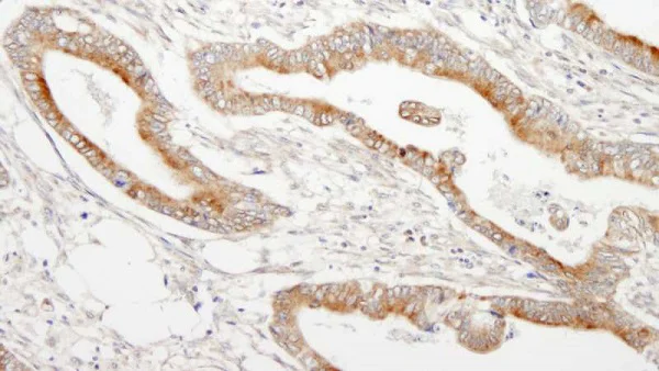 Immunohistochemistry (Formalin/PFA-fixed paraffin-embedded sections) - Anti-MAP7 antibody (AB240695)