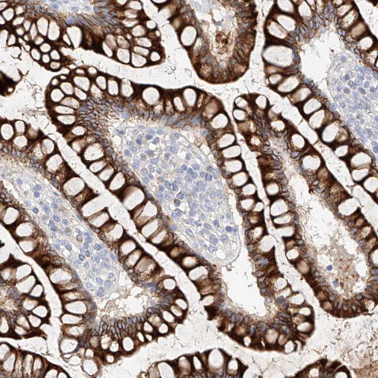 Immunohistochemistry (Formalin/PFA-fixed paraffin-embedded sections) - Anti-MAP7 antibody (AB251799)