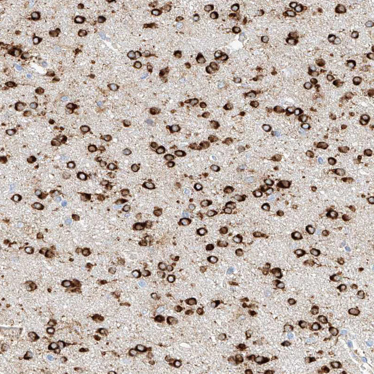 Immunohistochemistry (Formalin/PFA-fixed paraffin-embedded sections) - Anti-MAP7 antibody (AB251799)