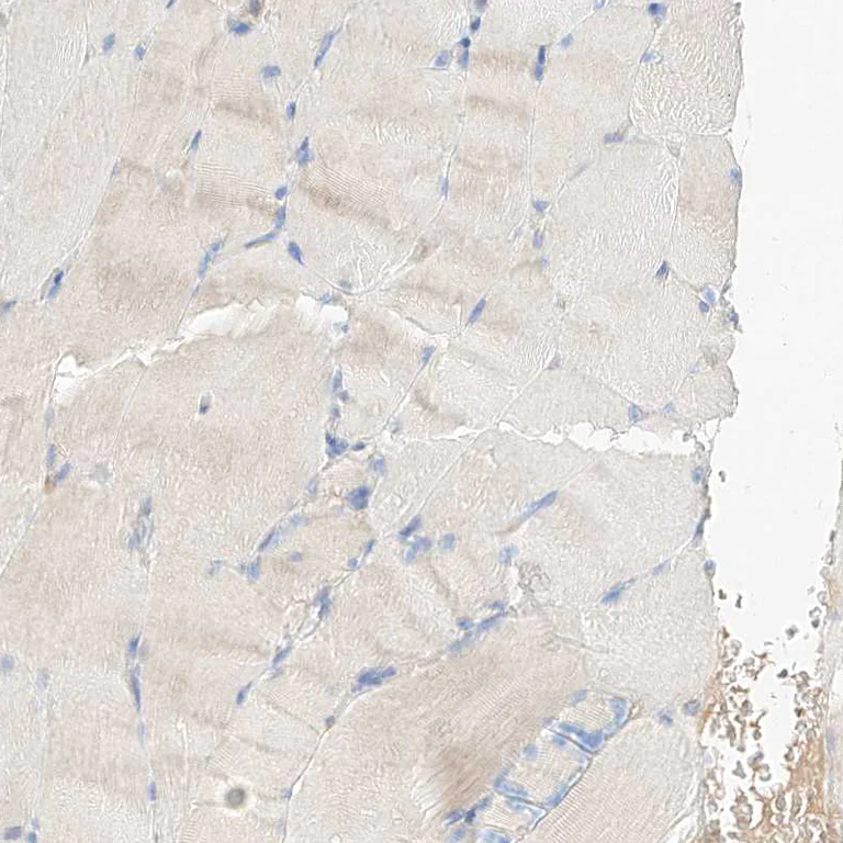 Immunohistochemistry (Formalin/PFA-fixed paraffin-embedded sections) - Anti-MAP7 antibody (AB251799)