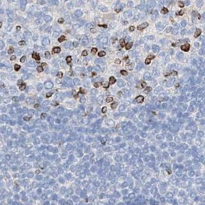 Immunohistochemistry (Formalin/PFA-fixed paraffin-embedded sections) - Anti-MAP7 antibody (AB251799)