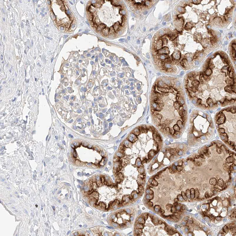 Immunohistochemistry (Formalin/PFA-fixed paraffin-embedded sections) - Anti-MAP7 antibody (AB251799)