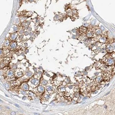 Immunohistochemistry (Formalin/PFA-fixed paraffin-embedded sections) - Anti-MAP7 antibody (AB251799)