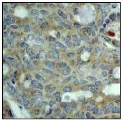 Immunohistochemistry (Formalin/PFA-fixed paraffin-embedded sections) - Anti-MAPK6/ERK3 antibody [EP1720Y] (AB53277)