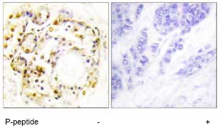 Immunohistochemistry (Formalin/PFA-fixed paraffin-embedded sections) - Anti-MAPK6/ERK3 (phospho S189) antibody (AB74032)