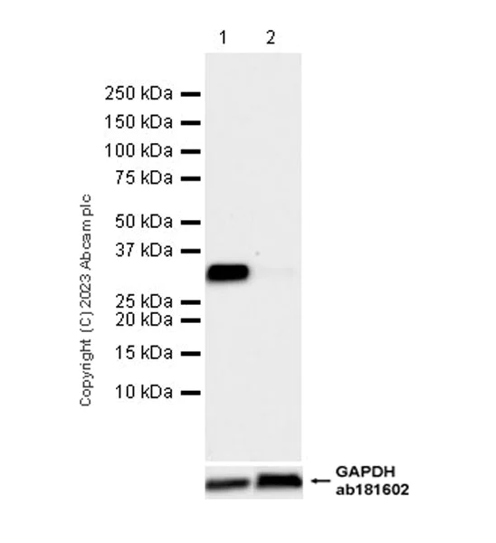 Western blot - Anti-MAPRE1/EB1 antibody [5/EB1] (AB308076)