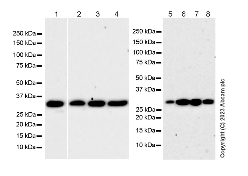 Western blot - Anti-MAPRE1/EB1 antibody [5/EB1] (AB308076)