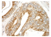 Immunohistochemistry (Formalin/PFA-fixed paraffin-embedded sections) - Anti-MAPRE1/EB1 antibody (AB117821), expandable thumbnail