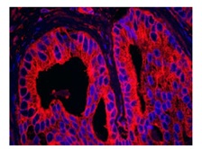 Immunohistochemistry (Formalin/PFA-fixed paraffin-embedded sections) - Anti-MAPRE1/EB1 antibody (AB117821), expandable thumbnail