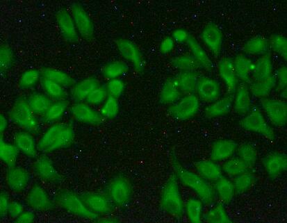 Immunocytochemistry/ Immunofluorescence - Anti-MAPRE1/EB1 antibody (AB232970), expandable thumbnail
