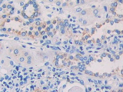 Immunohistochemistry (Formalin/PFA-fixed paraffin-embedded sections) - Anti-MAPRE1/EB1 antibody (AB232970), expandable thumbnail