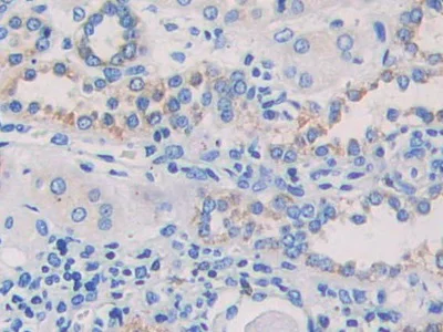 Immunohistochemistry (Formalin/PFA-fixed paraffin-embedded sections) - Anti-MAPRE1/EB1 antibody (AB232970)
