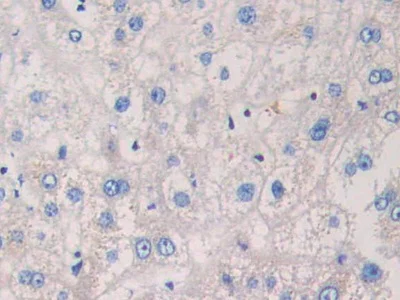 Immunohistochemistry (Formalin/PFA-fixed paraffin-embedded sections) - Anti-MAPRE1/EB1 antibody (AB232970)