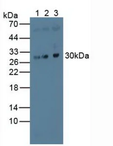 Western blot - Anti-MAPRE1/EB1 antibody (AB232970)