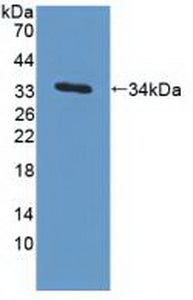 Western blot - Anti-MAPRE1/EB1 antibody (AB232970), expandable thumbnail