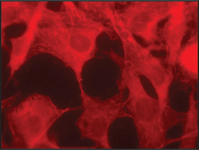 Immunocytochemistry/ Immunofluorescence - Anti-MAPRE1/EB1 antibody (AB50188)