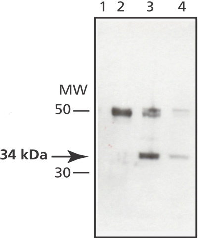 Immunoprecipitation - Anti-MAPRE1/EB1 antibody (AB50188), expandable thumbnail