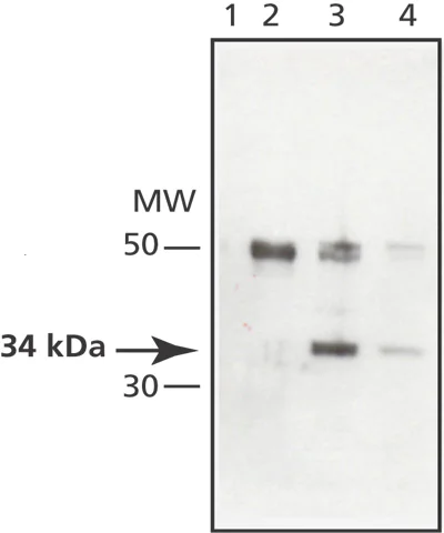 Immunoprecipitation - Anti-MAPRE1/EB1 antibody (AB50188)