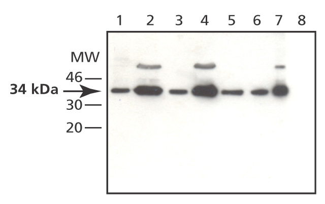 Western blot - Anti-MAPRE1/EB1 antibody (AB50188), expandable thumbnail