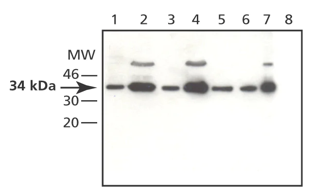 Western blot - Anti-MAPRE1/EB1 antibody (AB50188)