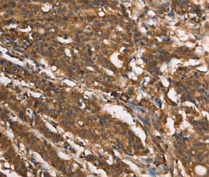 Immunohistochemistry (Formalin/PFA-fixed paraffin-embedded sections) - Anti-MARC1 antibody (AB198692)