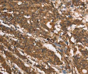 Immunohistochemistry (Formalin/PFA-fixed paraffin-embedded sections) - Anti-MARC1 antibody (AB198692)