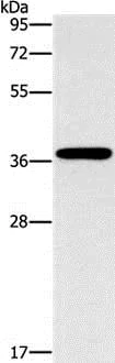 Western blot - Anti-MARC1 antibody (AB198692)