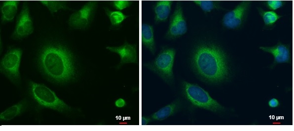 Immunocytochemistry/ Immunofluorescence - Anti-MARC1 antibody (AB229082)